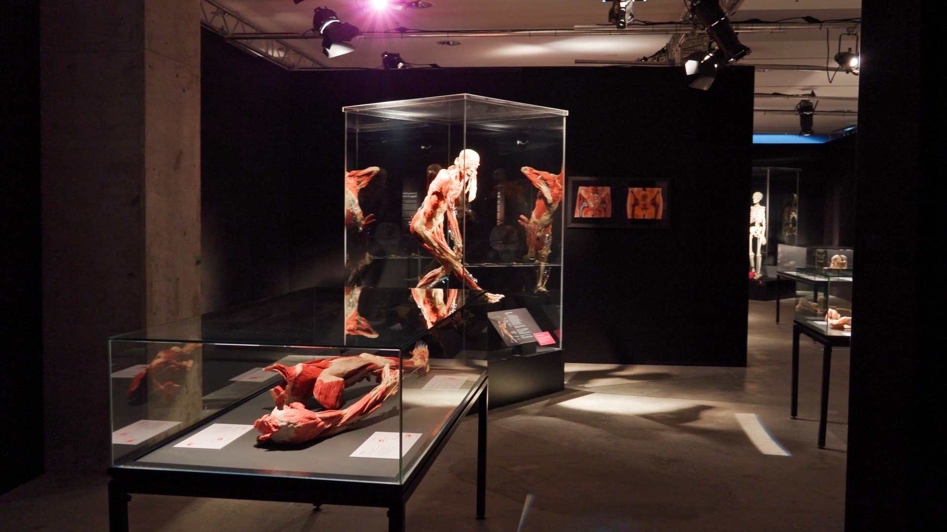 A Look Under the Skin: 'BODY WORLDS' Arrives in Brisbane to Unpack the Anatomy of Happiness